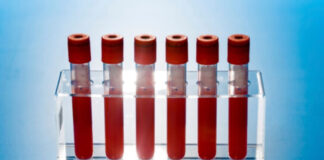 New Cancer Blood Test Sparks Hope, But Raises Safety Concerns