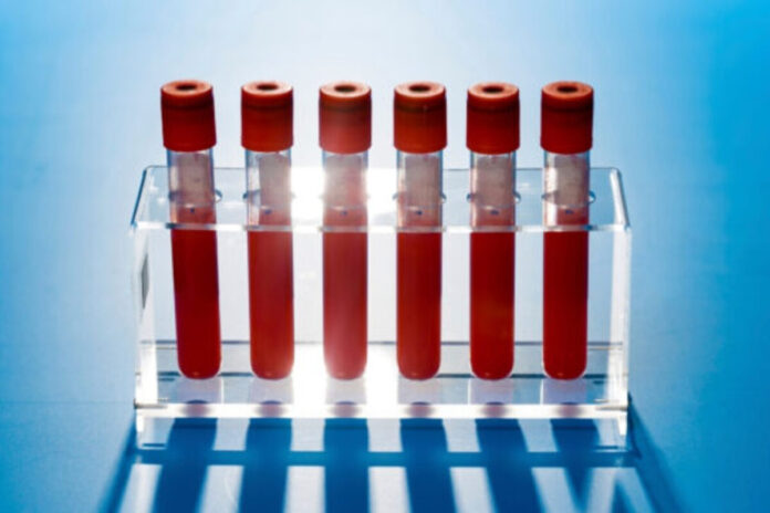 New Cancer Blood Test Sparks Hope, But Raises Safety Concerns