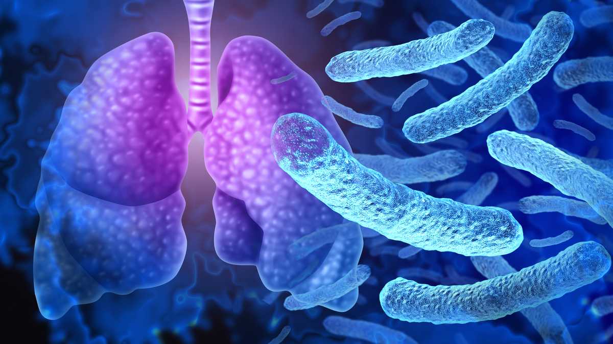 Cincinnati Hospital Reports Two Cases of Legionnaires’ Disease