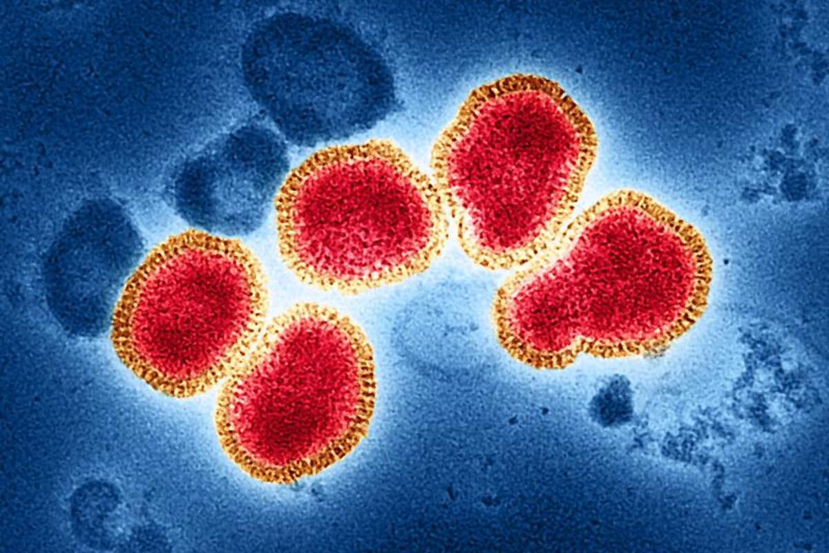 Doctors Warn About New Dangerous Flu Strain Spreading Worldwide